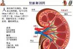 腎小球腎炎 腎炎