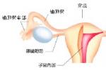 尿崩癥 垂體性尿崩癥 中樞性尿崩癥