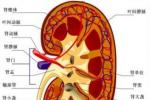 狼瘡性腎炎 M32.105+ LN 狼瘡腎