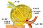 痛風性腎病