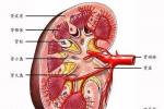 腎動脈血栓形成和栓塞