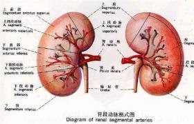 小兒腎積水 兒童腎積水