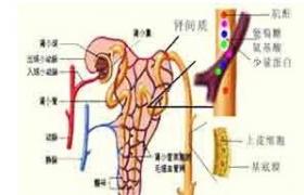 隱匿性腎小球腎炎 無癥狀性蛋白尿或血尿 無癥狀性蛋白尿及血尿 隱匿型腎炎 隱匿性腎炎