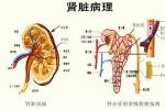 隱匿性腎小球腎炎 無癥狀性蛋白尿或血尿 無癥狀性蛋白尿及血尿 隱匿型腎炎 隱匿性腎炎