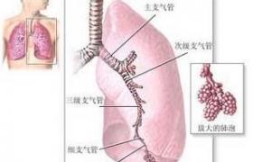 放射性肺炎 J70.001 輻射性肺炎