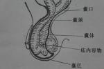 腹外疝 K40.951 Abdominal external hernia