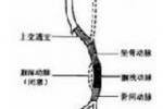 膕血管陷迫綜合征 膕動靜脈陷迫綜合征 膕動脈陷迫綜合征 膕血 膕血管卡壓綜合征 膕血管陷夾綜合征 膕血管陷迫綜合癥 假性膕窩陷迫綜合征