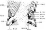 腰疝 K45.803 背疝