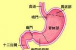 先天性肥厚性幽門狹窄 新生兒肥厚性幽門狹窄 先天肥大性幽門狹窄 CHPS ongenital hypertrophic pyloric stenosis