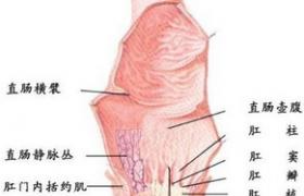 肛門失禁 大便失禁