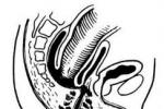 直腸內套疊 不完全性直腸脫垂 隱性直腸脫垂 直腸內脫垂