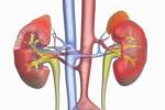單側腎缺如 單側腎 單側腎未發育 單側腎發育不全 孤立腎