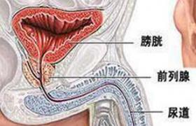 老年人前列腺癌 老年前列腺癌