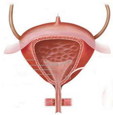 老年人膀胱癌 老年膀胱癌 senile carcinoma of urinary bladder