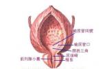 老年人膀胱癌 老年膀胱癌 senile carcinoma of urinary bladder