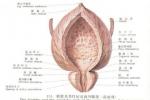 膀胱平滑肌肉瘤 膀胱平滑肌惡性腫瘤