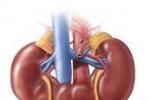 馬蹄形腎 Q63.101 蹄鐵形腎 蹄鐵腎 馬蹄腎