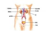 膀胱輸尿管反流 N13.701 尿頻伴尿急和 發熱 血尿 惡心與嘔吐 腰背痛