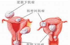 輸尿管損傷 S37.1051 