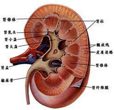 腎盞積水