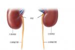 腎上腺性征異常癥 Adrenal sexuality anomalies