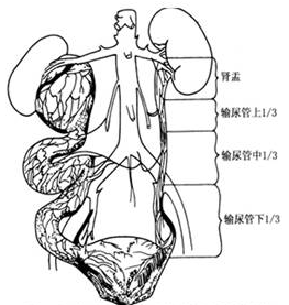 先天性巨輸尿管 Q62.201 先天性輸尿管末端功能性梗阻 原發性巨輸尿