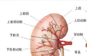 腎盂積水