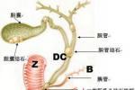 膽囊癌