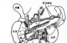 老年膽石病 老年膽石癥 老年人膽石病