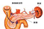 急性出血壞死型胰腺炎