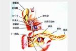 急性出血壞死型胰腺炎