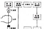 胰腺瘤 M81550 3 胰腺良性腫瘤