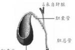 急性膽管炎 K83.011 