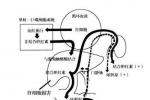 Rotor綜合征