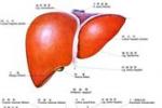 胰石癥 胰腺結石