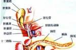 胰石癥 胰腺結石