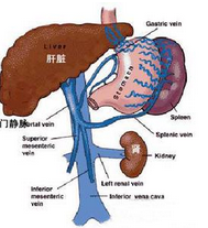 門靜脈血栓形成 I81.X02 門靜脈血栓癥