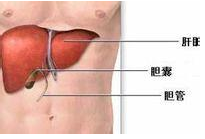 醫源性膽管損傷