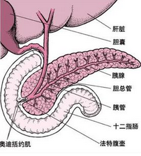 胰高血糖素瘤