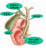 老年人膽囊癌 老年膽囊癌