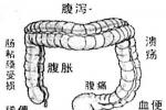 功能性胃腸病 功能性消化系統疾病