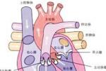 風濕性二尖瓣狹窄 I05.001 風濕性心臟瓣膜病