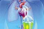 單側肺氣腫 J43.052 單側透明肺 先天性肺囊腺樣畸形 先天性肺葉