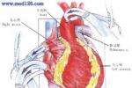 冠狀動脈異位起源 冠狀動脈起源異常