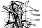經膈肌肋間疝 肋間胸膜腹膜疝 肋間胸膜腹膜疝