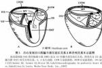 左心室雙出口 Q20.251 