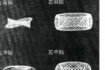 抽動癥 抽動－－穢語綜合征