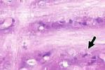 腦震蕩 S06.001 concussion of brain