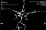 眩暈 R42.X01 前庭系統性眩暈 前庭性眩暈 真性眩暈