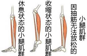 肌肉痙攣 抽筋